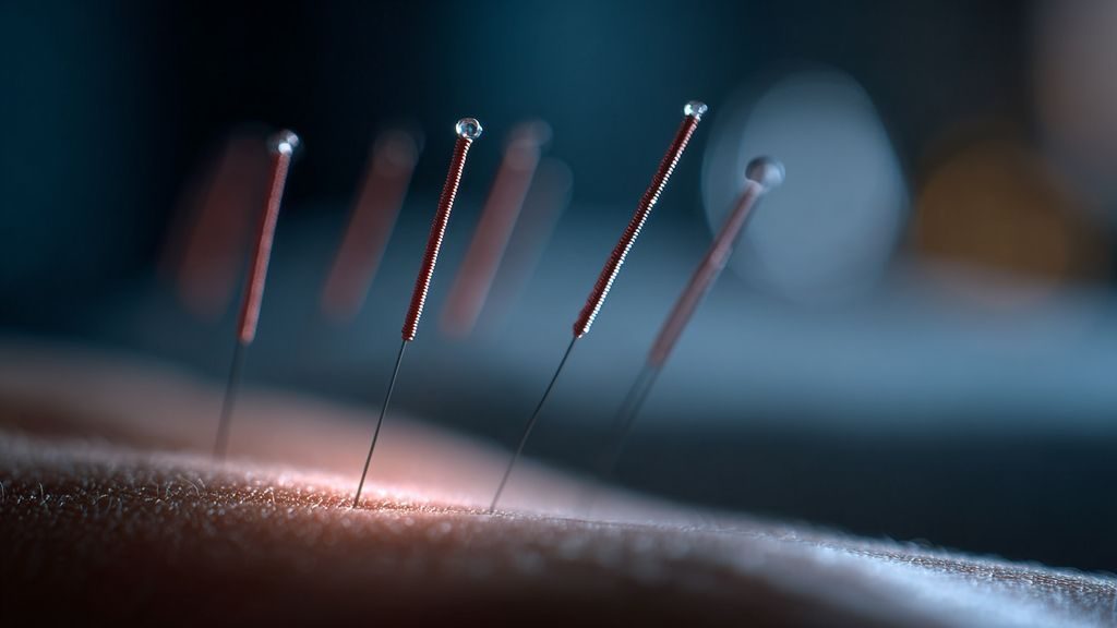 Quels facteurs influencent l’efficacité de l’ouverture des points d’acupuncture ?